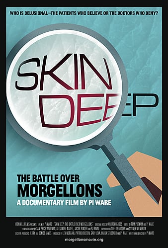 Watch Full Movie :Skin Deep: The Battle Over Morgellons (2019)