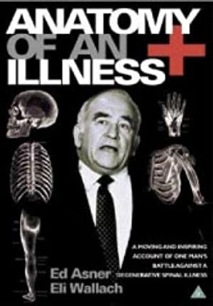 Watch Full Movie :Anatomy of an Illness (1984)